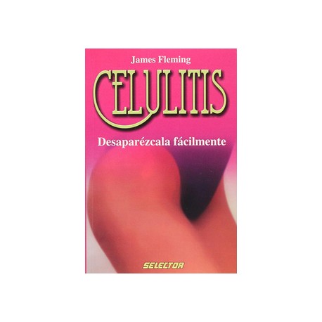 CELULITIS